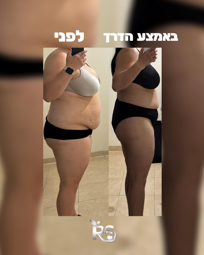 תמונת לפני ובאמצע הדרך של מתאמנת בליווי, מבט מהצד