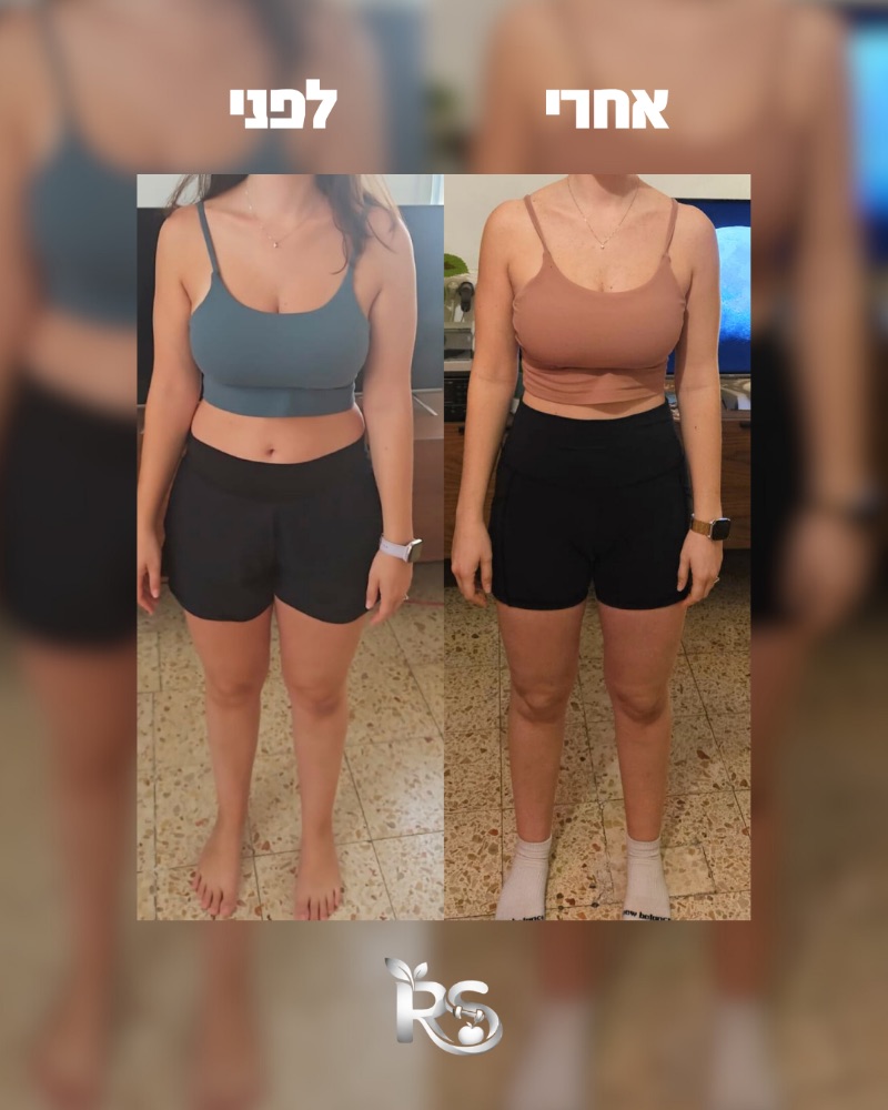 תמונת לפני ואחרי של מתאמנת בליווי, מבט מקדימה