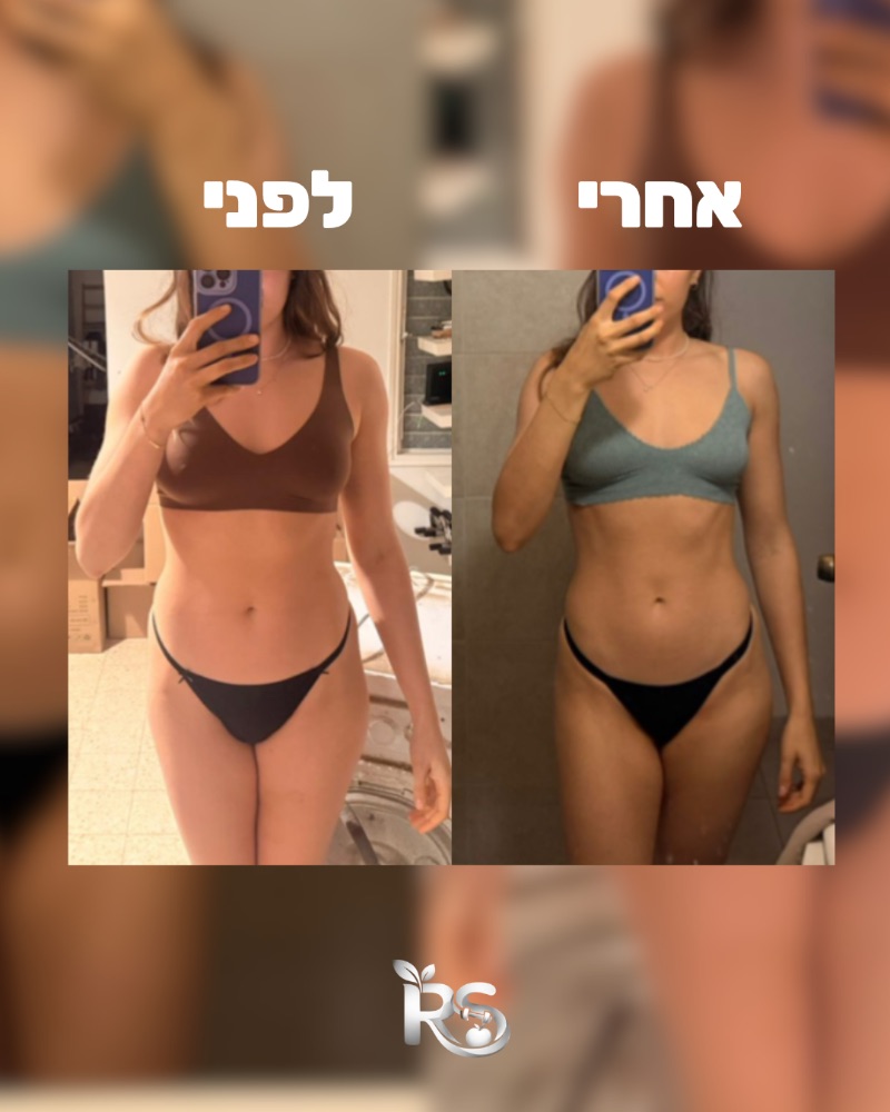 תמונת לפני ואחרי של מתאמנת בליווי, מבט מקדימה